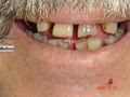 Robert Collins Dental Prosthetist image 4