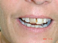 Robert Collins Dental Prosthetist image 6