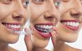 Siana Dental image 1