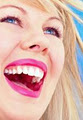 Smile For Life Invisalign-Melbourne Zoom-teeth-whitening Cosmetic- Dent Implants image 1