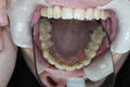 South Tweed Orthodontics image 3