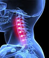 Spinal Care Qld image 1