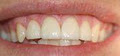 Springfield Lakes Central Dental/Implant Clinic image 3