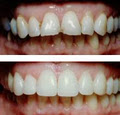 Today's Dentistry - North Brisbane Family and Cosmetic Dentist image 2