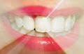Uniquely You Teeth Whitening image 4
