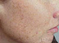 Bliss Laser and Cosmetic Clinic image 1