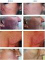 Cosmetic Laser Clinic image 4