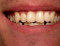 Frenchs Forest Dental image 4