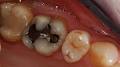 Hartwell Dental Excellence image 4