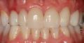Hartwell Dental Excellence image 5