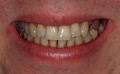 Hartwell Dental Excellence image 6