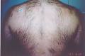 Laser Skin Rejuvenation & Hair Removal Clinic image 3