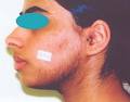 Laser Skin Rejuvenation & Hair Removal Clinic image 4
