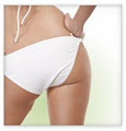 Results Laser Hair Removal Clinic Sydney image 4