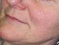 Facial Attraction Laser & Skin Clinic image 4