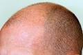 Hairline Solutions image 2