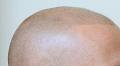 Hairline Solutions image 3