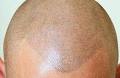 Hairline Solutions image 4