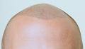 Hairline Solutions image 6