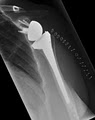 Ash Moaveni - Knox Orthopaedic Clinic - Shoulder Elbow and Hand logo