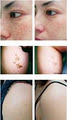 Evolution Laser Hair Removal Clinic image 3