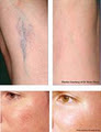 Evolution Laser Hair Removal Clinic image 4