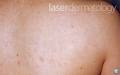 Laser Dermatology image 4