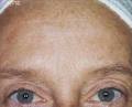 Maram's Clinic Laser IPL Hair Removal image 5