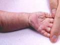 Psoriasis & Skin Clinic image 3