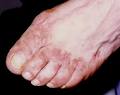 Psoriasis & Skin Clinic image 1
