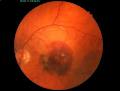 Vision Retinal Institute image 4