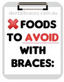 Dental Braces image 5