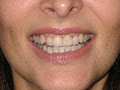 Dr Brett Kerr - Orthodontist Brisbane - Invisalign specialist clear braces image 6