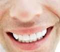 Invisible braces specialist. Dr John Jenner Orthodontist. image 2