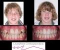 LiveWire Orthodontics image 2
