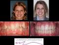 LiveWire Orthodontics image 4