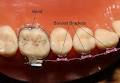 Noosa Junction Orthodontics image 4