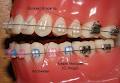 Noosa Junction Orthodontics image 1