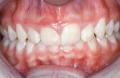 Orthodontist Bondi Junction image 2