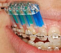 Platinum Orthodontics - Mooloolaba image 2