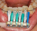 Platinum Orthodontics - Mooloolaba image 5