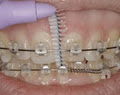 Platinum Orthodontics - Mooloolaba image 6