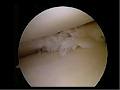 Shoulder and Knee Orthopaedics Perth image 4