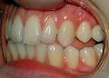 Specialist Orthodontist Dr Kerry Lester image 3