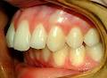 Specialist Orthodontist Dr Kerry Lester image 5