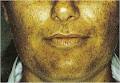 Ashbury Skin Care & Laser Clinic image 2