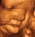 Precious Previews 3d/4d Ultrasound image 2