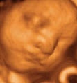 Precious Previews 3d/4d Ultrasound image 3