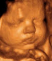 Precious Previews 3d/4d Ultrasound image 4