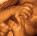 Precious Previews 3d/4d Ultrasound image 5